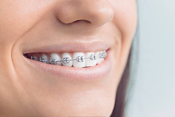 Best Traditional Braces  in Wilderness Rim, WA