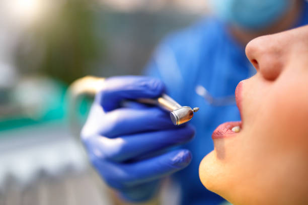 Best Teeth Whitening  in Wilderness Rim, WA